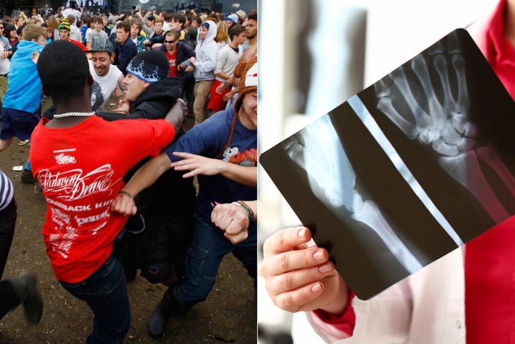 What is Your Worst Mosh Pit Accidents? Reddit Customers Weigh In